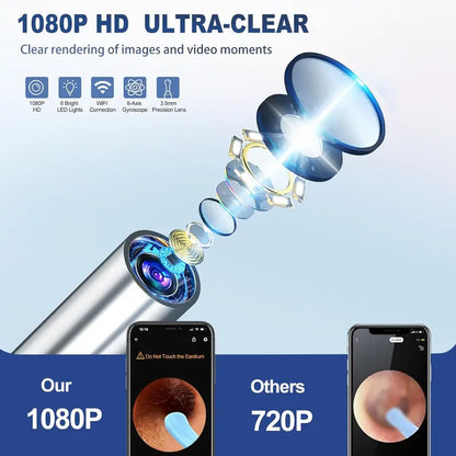 HD Visual Earwax Removal Tool with 1080P Camera