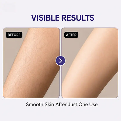 Gentle Hair Removal Cream for Sensitive Skin – Fast & Painless Depilatory for Underarm, Bikini & Body – No Razor Bumps, Smooth Results in 5-10 Minutes